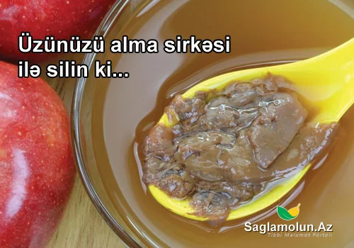 Üzünüzü alma sirkəsi ilə silin ki...