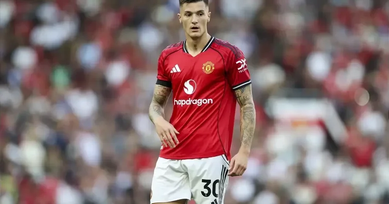 “Mançester Yunayted”in hücumçusunun vəziyyətinə aydınlıq gətirilib