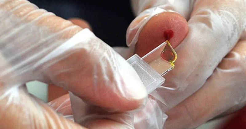 Yeni qan qrupu yaradılır: Yalnız 50 nəfərdə var