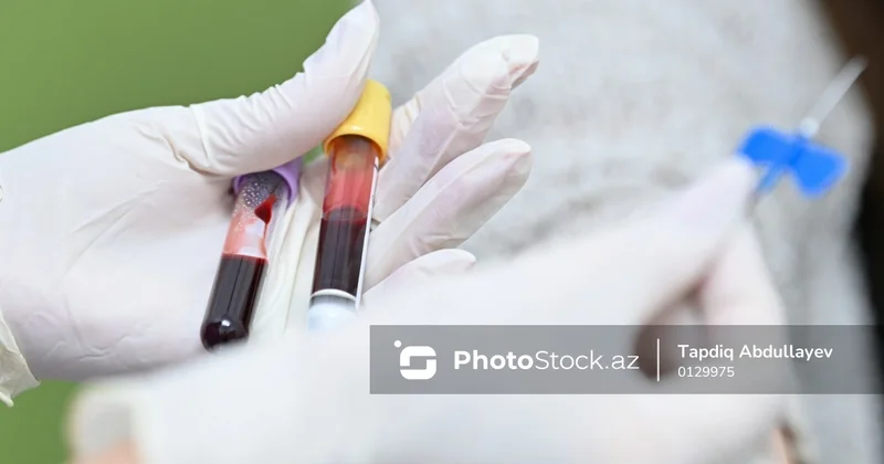 Koronavirusdan sağalan insanların qanında qeyri adi dəyişikliklər aşkar edildi