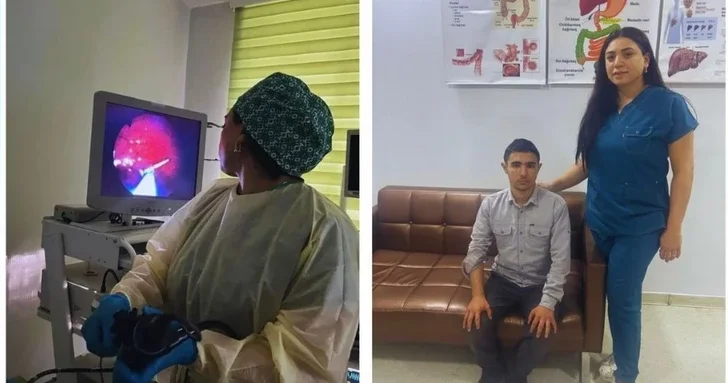 В Баку врачи провели эндоскопию и извлекли гвоздь из желудка подростка