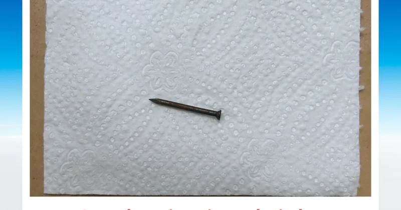 Bakıda azyaşlının mədəsindən mismar çıxarıldı FOTO