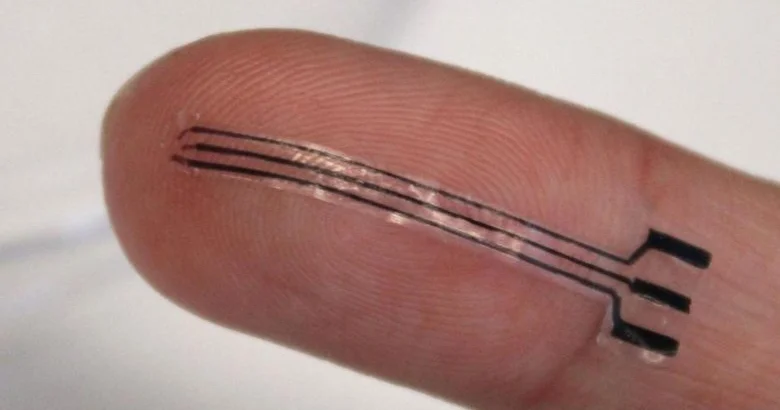 “Mühəndislər dərmansız təzyiqi 15 faiz azaldan 3D implant hazırlayıb“ Yeni tədqiqat