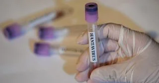 Daha bir ölkədə hantavirus TAPILDI