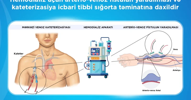 İTSDA: Xroniki böyrək çatışmazlığı olan vətəndaşlara 1480 dən çox ilkin hemodializ xidməti göstərilib