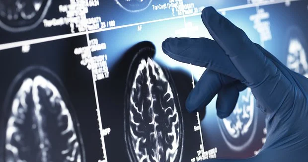 Alzheimer xəstəliyi ilə mübarizədə yeni üsul...