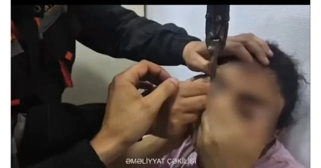 Sabunçuda göz qapağı paltar zəncirbəndinə ilişən qadın xilas edildi VİDEO