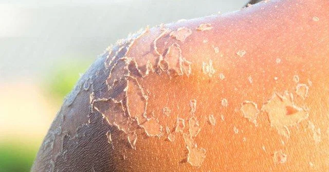 Terapevt allerqoloq: Saatlarla “zaqar” məsləhət deyil