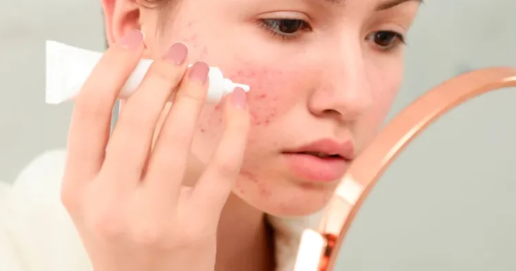 Bu kosmetik vasitələr qızartıları azaldır və dərini qoruyur
