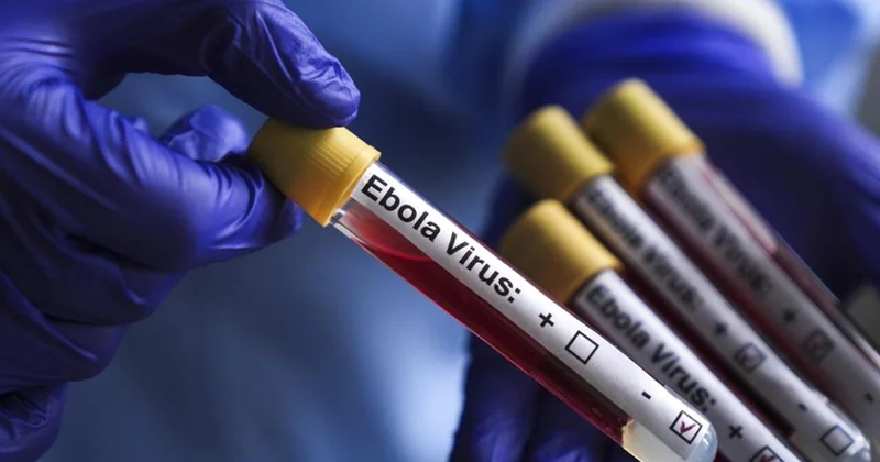 “Epidemiya görünməmiş sürətlə yayılır” ÜST dən xəbərdarlıq
