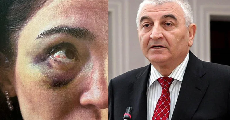 MSK SƏDRİ ÜÇÜN “SEMİÇKA PULU”... Pənahovun oğlunda 300 minlik qızıl zinət əşyası hardandır?