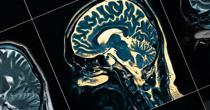 Alzheimer özünü belə göstərir: Yaddaş itkisindən əvvəl 4 siqnal