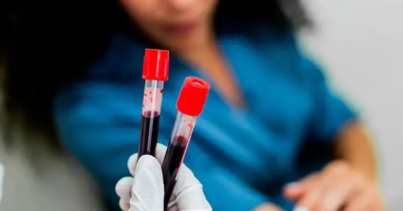 50 növ xərçəngi aşkarlayan qan testi ümidverici nəticə verib