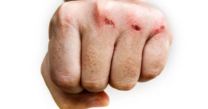 Виртуальный конфликт в TikTok закончился реальной дракой и арестом блогера в Самухе