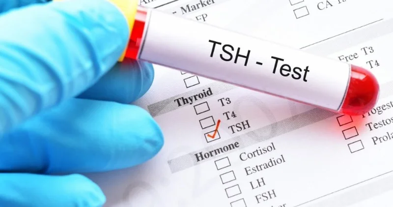 TSH (Tiroid Stimulating Hormon) Testi TSH nədir?