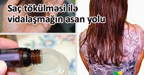 Saç tökülməsi ilə vidalaşmağın asan yolu