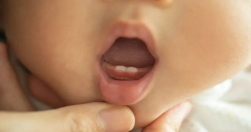 Hamiləlikdə yaşanan stress körpələrin dişlərini daha tez çıxara bilər