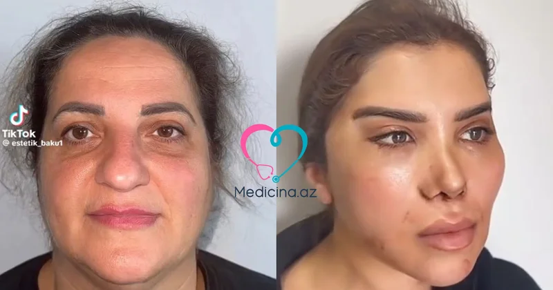 60 yaşlı qadının dəyişimi müzakirələrə səbəb oldu VİDEO