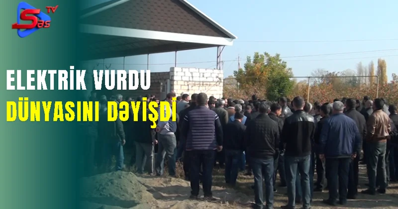 Elektrik vurdu, dünyasını dəyişdi