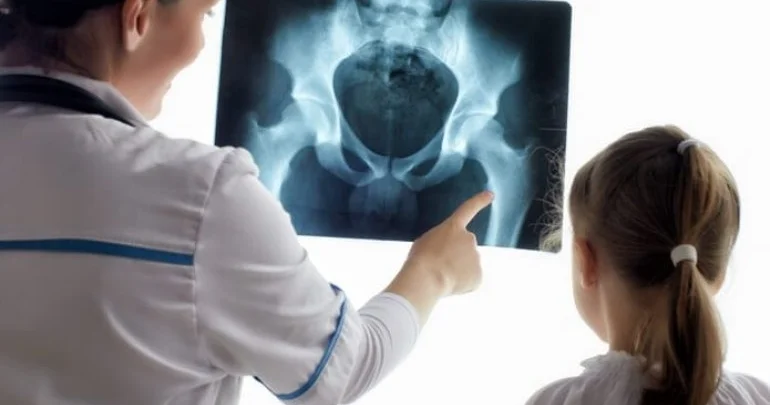 Həkimdən XƏBƏRDARLIQ: “Uşaqlar lazımsız yerə rentgen ediləndə…”