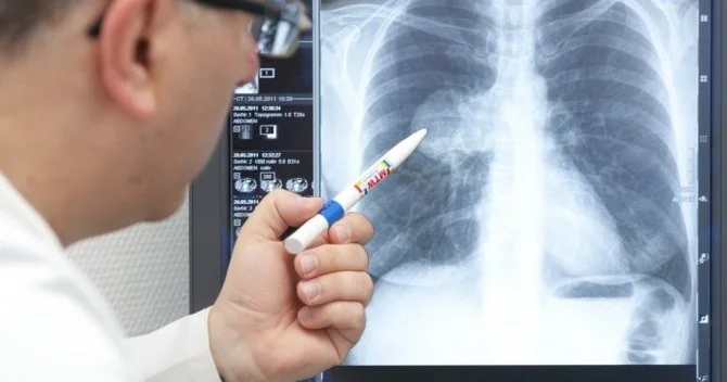 Bakıda yayılan xəstəlik təhlükəli H3N2 virusudur? həkimdən xəbərdarlıq