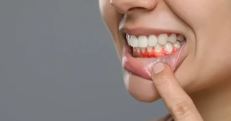 Diş əti problemləri hansı xəstəliklərə yol aça bilər?