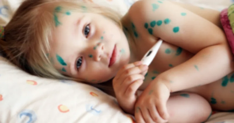 Su çiçəyinə yoluxmada artım olub