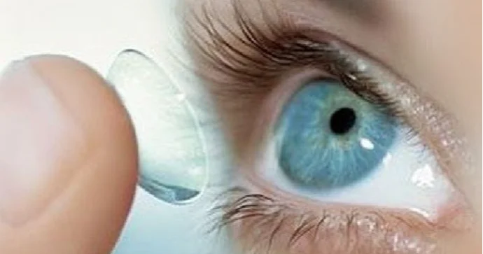 Göz linzalarından kosmetik vasitə kimi istifadə yanlışdır Oftalmoloqdan AÇIQLAMA