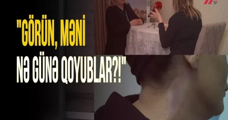 Uğursuz əməliyyatın qurbanı danışır: Cəhənnəmi yaşadım, çapıq qaldı” VİDEO
