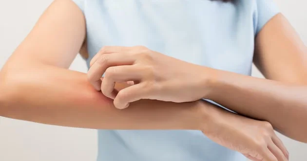 Bədəninizdəki qaşınma xərçəng xəbərdarlığı ola bilər DİQQƏT!