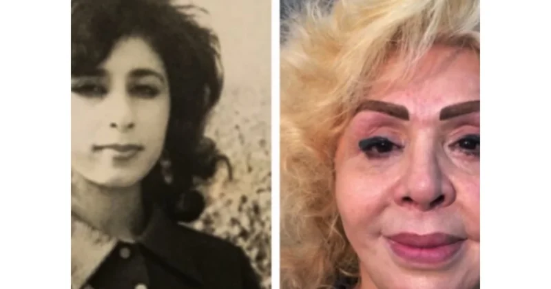 Müğənnilərin illər əvvəlki və indiki halı MÜZAKİRƏ YARATDI FOTOlar