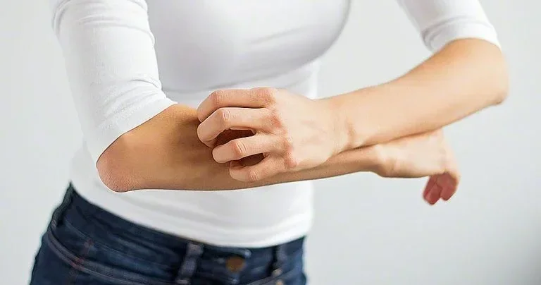 Dəridə qaşınma nədən xəbər verir?