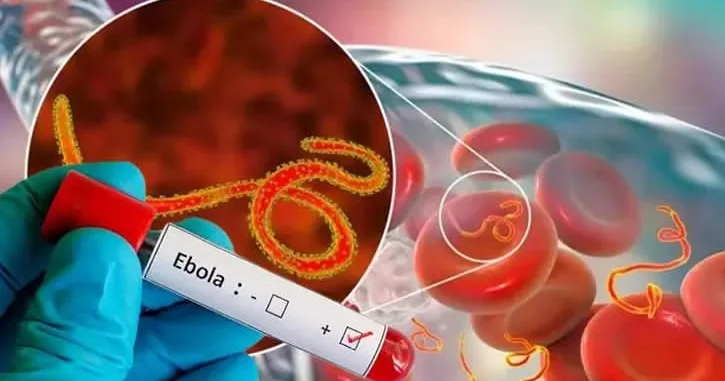 ÜST də fövqəladə iclas: Yayılma sürəti çoxdur