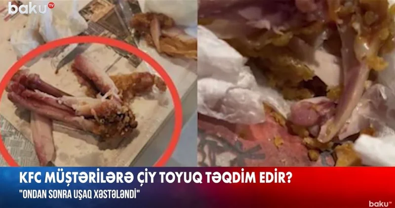 KFC Азербайджан в центре скандала: Покупатель пожаловался на сырое мясо ВИДЕО