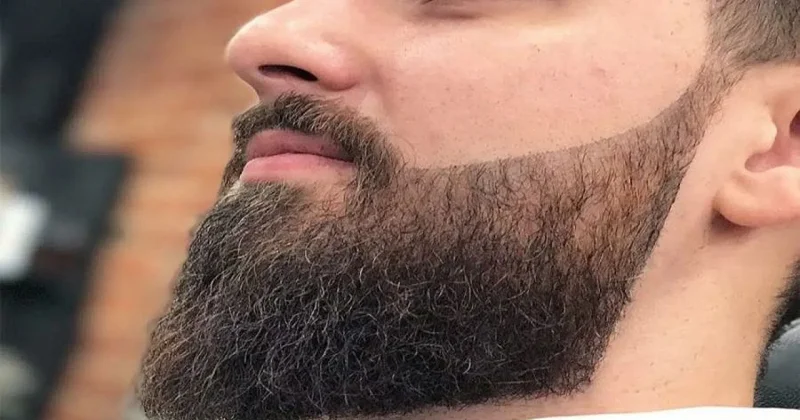 Saqqal saxlayanların NƏZƏRİNƏ “Ekzema, psoriaz, seboreik dermatit...”