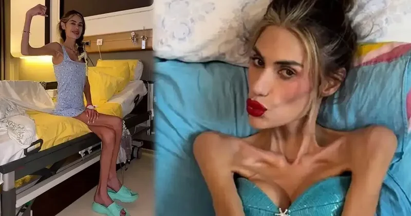 Çəkisi 23 kiloqrama düşən məşhurdan xəbər var