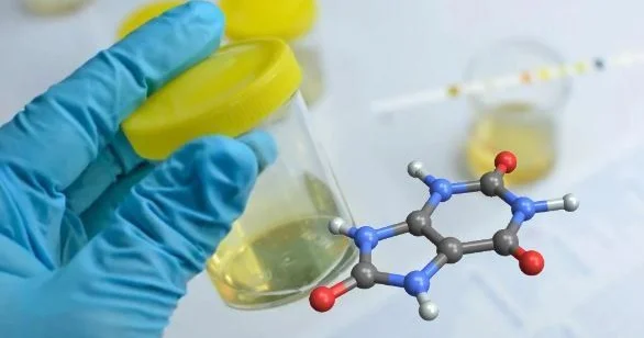 Sidik turşusunun artması 5 xəstəliyə səbəb olur