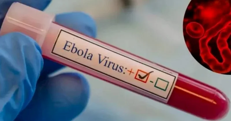 Ebola yenidən can alır: Yeni ştamma qarşı hələ ki, dərman yoxdur!