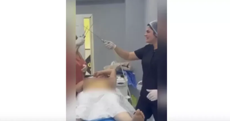 В Азербайджане врач устроил шоу прямо в операционной скандальное видео