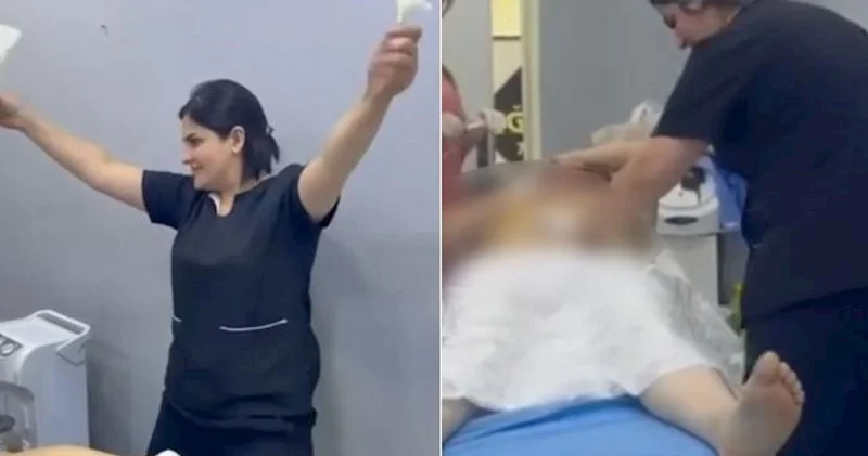 Prokurorluq estetik əməliyyat proseduru ilə bağlı yayılan görüntünü araşdırır