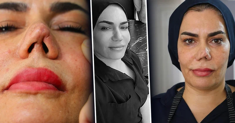 Aynaya baxa bilməz hala gəldi 2 uşaq anasının həyatı kabusa çevrildi