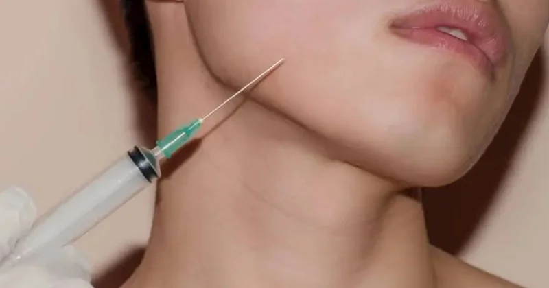 “Vefa Esthetik Center”lə bağlı şikayətlər artır: Keyfiyyətsiz botoks istifadə edilir?