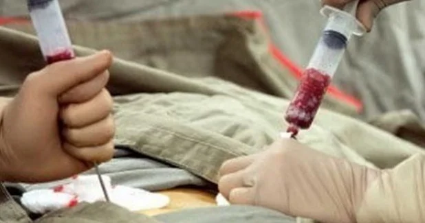 Sümük iliyi donorluğu həqiqətən də təhlükəsizdir?