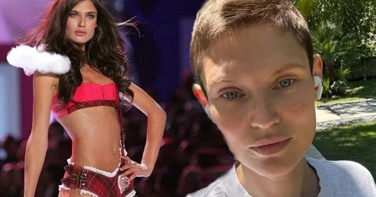 Xərçəng xəstəsi olan model podiuma BURAXILMADI