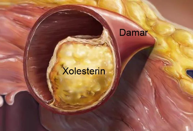 Xolesterini dərmansız aşağı salmağın 3 təbii üsulu