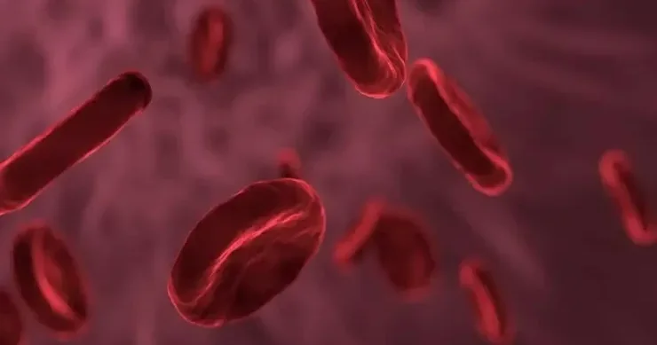 Hansı insanların tromboza ən çox həssas olduğu AÇIQLANDI