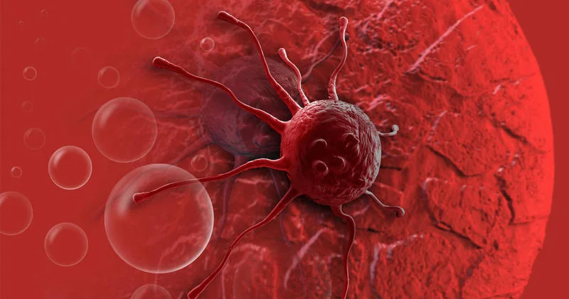 çirkli hava bu xərçəng növünün yaranmasına səbəb olur KONKRET