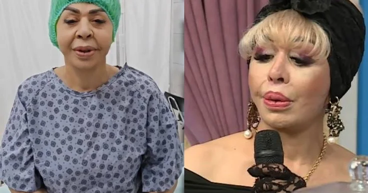 Ruhəngiz Allahverdiyeva plastik əməliyyatdan sonra Foto