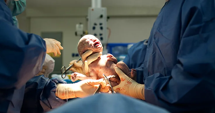 “Qeysəriyyə əməliyyatlarının sayı 10 faizədək azalıb”