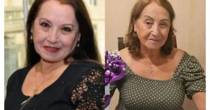 “Rejissor dedi ki, belə qız ola bilməz, gözləri oynayır” FOTOLAR